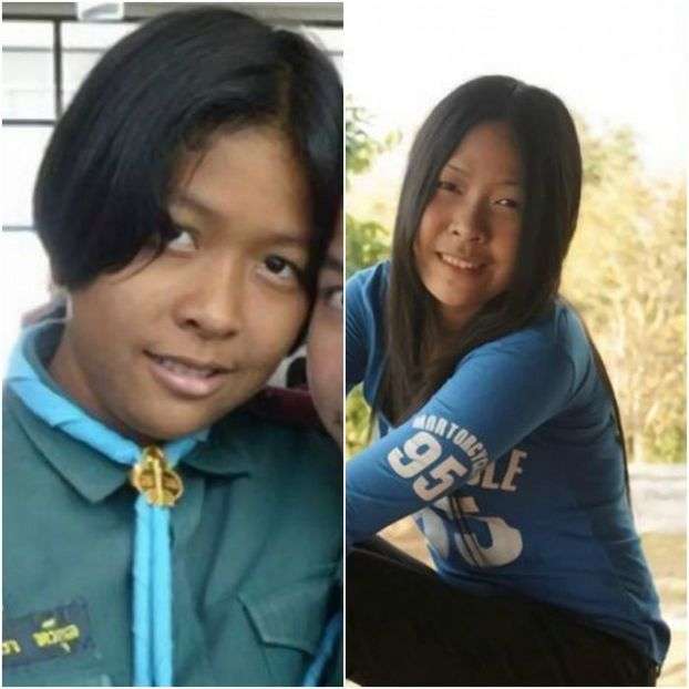 Gadis Hitam Jadi Cantik 1