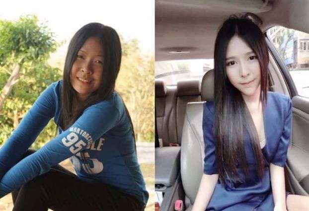 Gadis Hitam Jadi Cantik 2