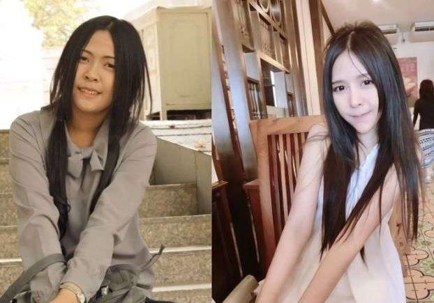 Gadis Hitam Jadi Cantik 4