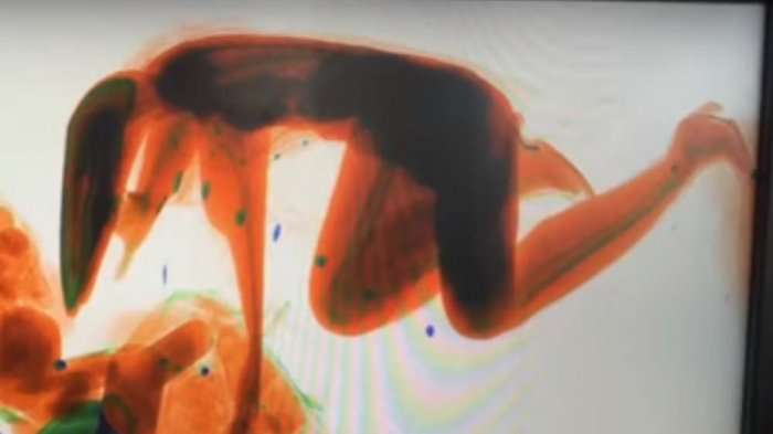Heboh Wanita Masuk Mesin X-Ray