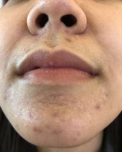 Shutterstock Shutterstock