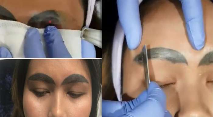 Proses pemulihan tato alis dengan laser