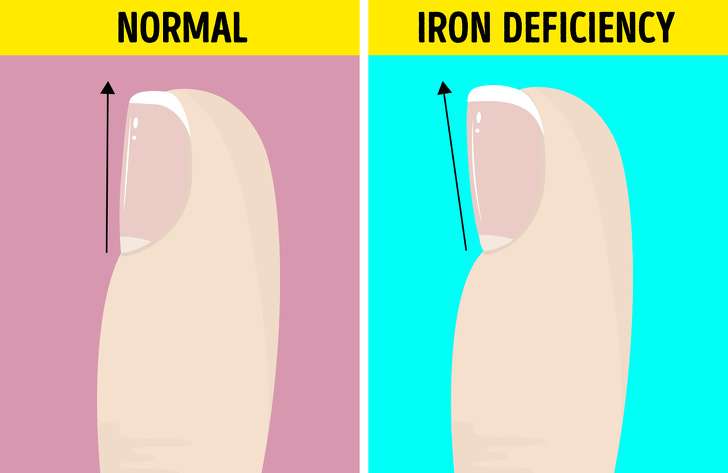 Cara Mengetahu Penyakit di Kaki