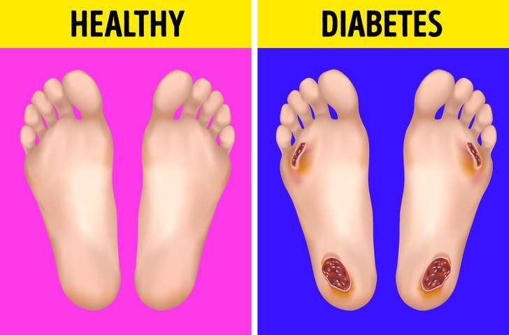 Cara Mengetahu Penyakit di Kaki