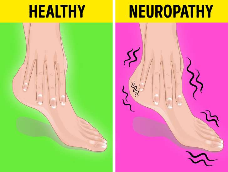 Cara Mengetahu Penyakit di Kaki