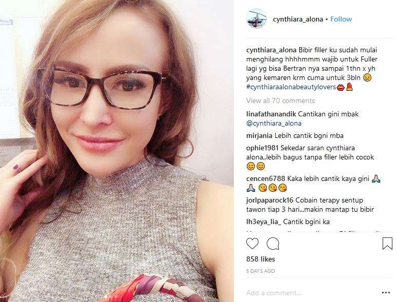 Cynthiara Alona filler