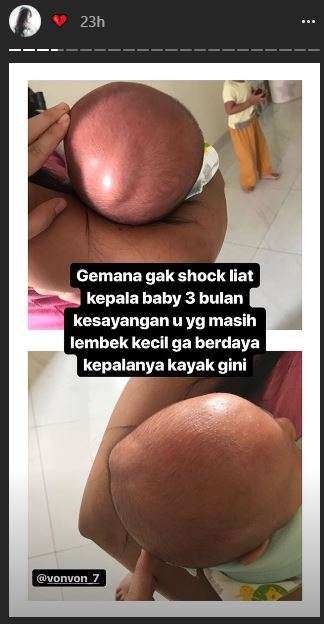 Benjol