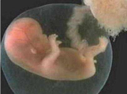 Bayi Parasit Bayi Parasit
