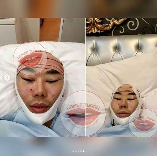 unggahan robby purba