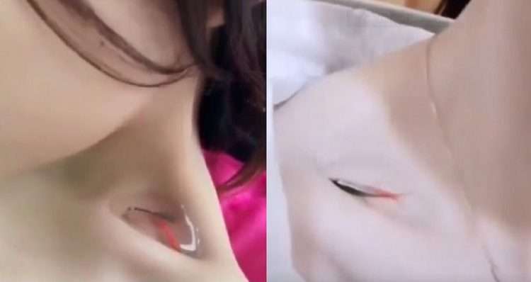 Tantang fish in collarbone