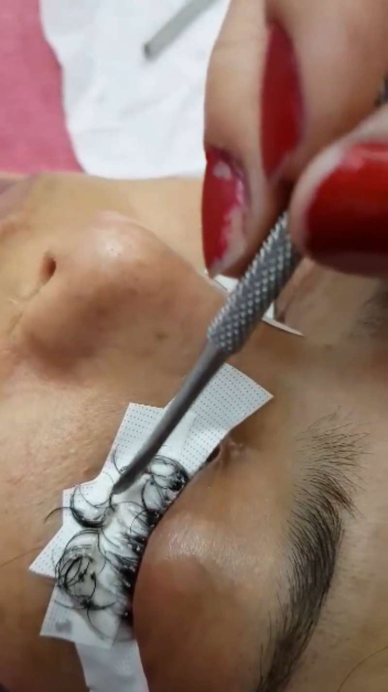 Matanya menjadi bengkak.