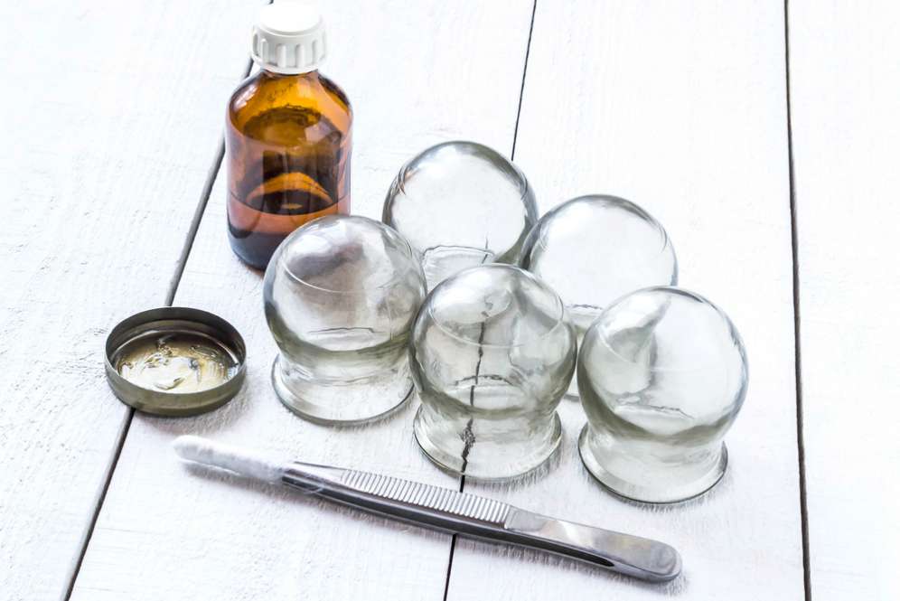 Manfaat Luar Biasa Terapi Bekam untuk Kecantikan