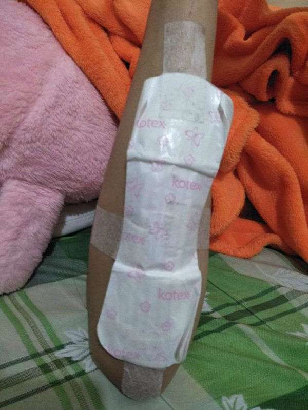 Pembalut untuk membebat luka di lengan