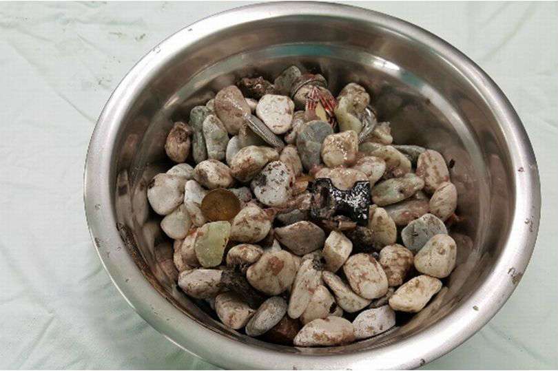 Barang-barang yang ditelan oleh pasien