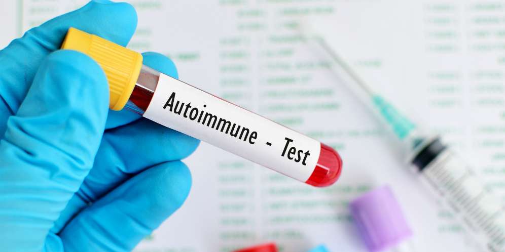 Autoimun