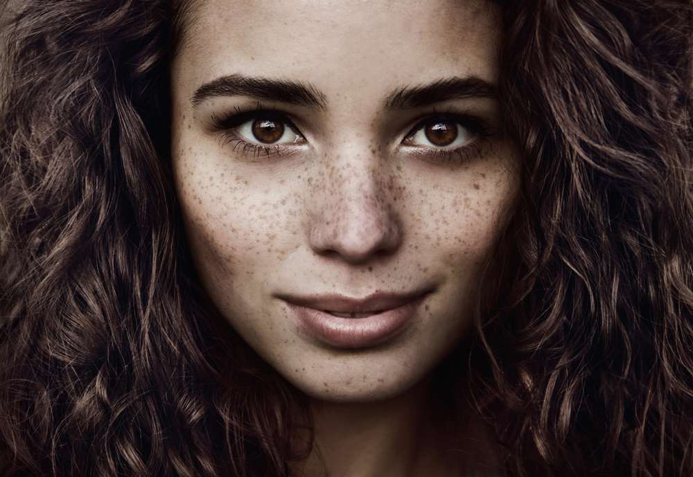 Face Freckles