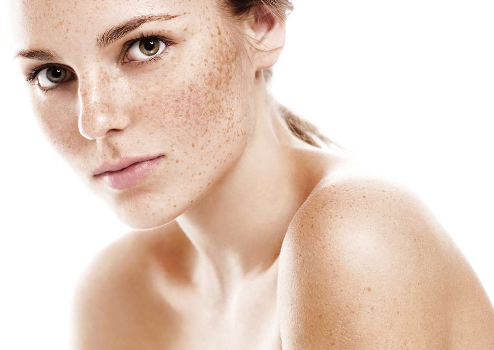 Face Freckles