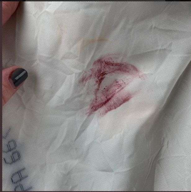 Hanya sedikit yang menempel di airbag.