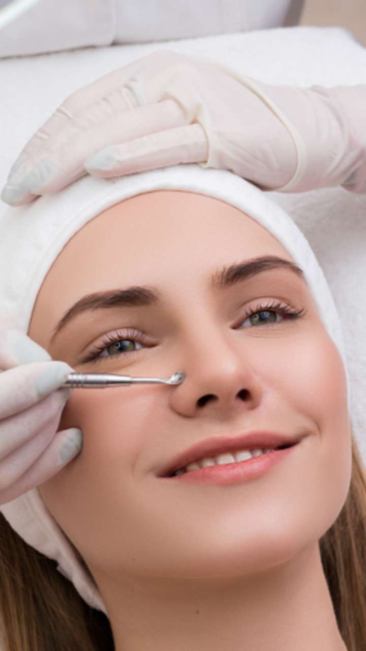 Ilustrasi Komedo dan Jerawat