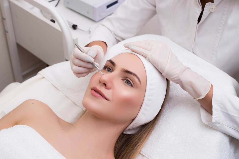 Chemical Peel
