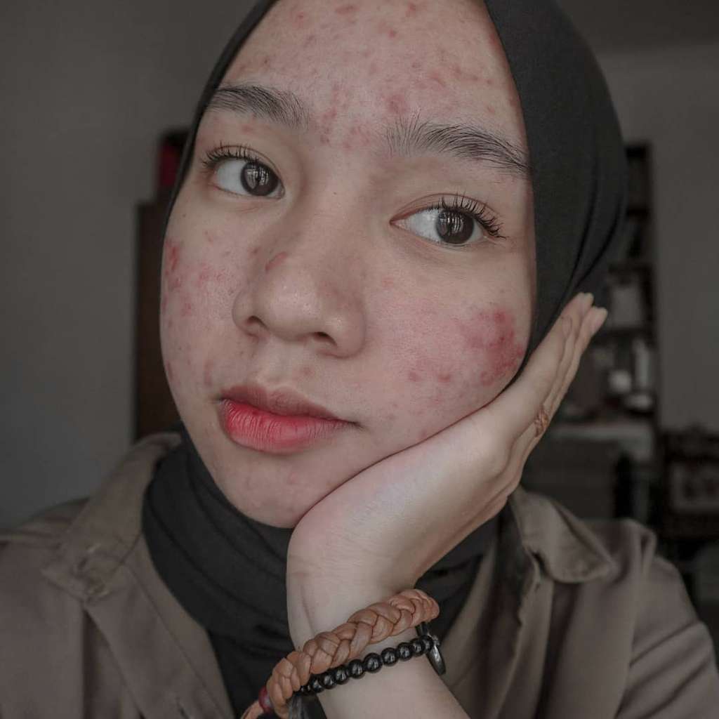 Novia Nur Ismi