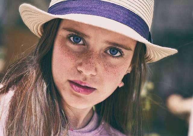 Freckles