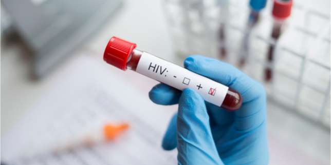 Inilah 3 Tahapan Infeksi HIV, Kalian Wajib Tahu!