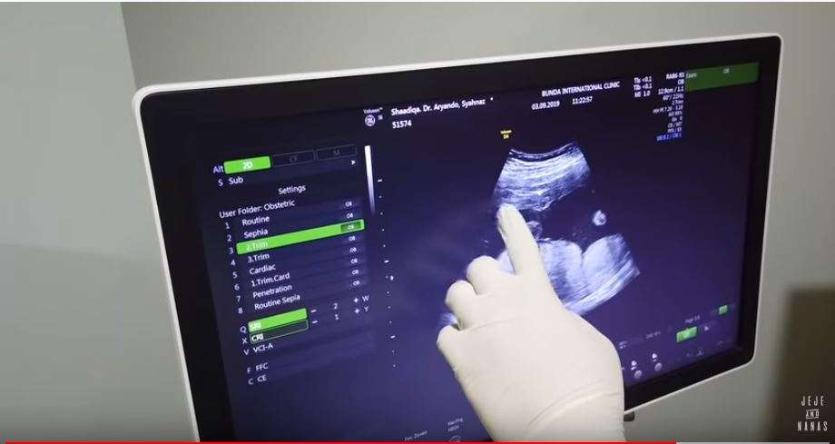 bayi kembar syahnaz sadiqah