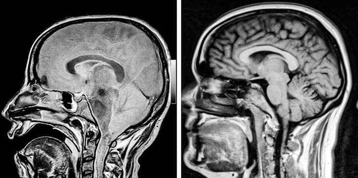 X-ray