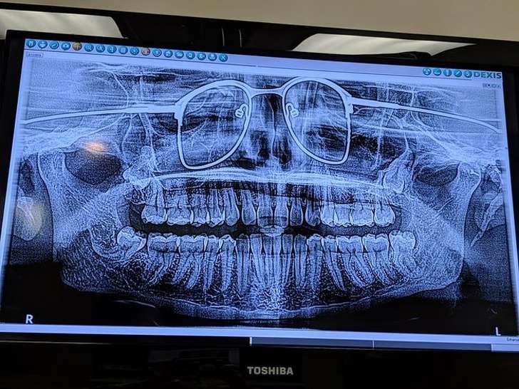 X-ray