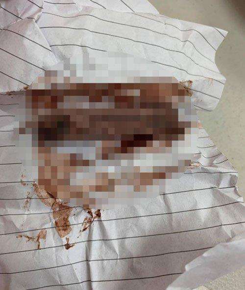 Tak menyangka di dalam jahitan saku belakang celana ada pembalut bekas.
