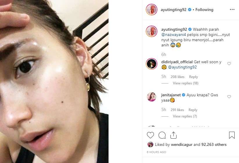 ayu ting ting