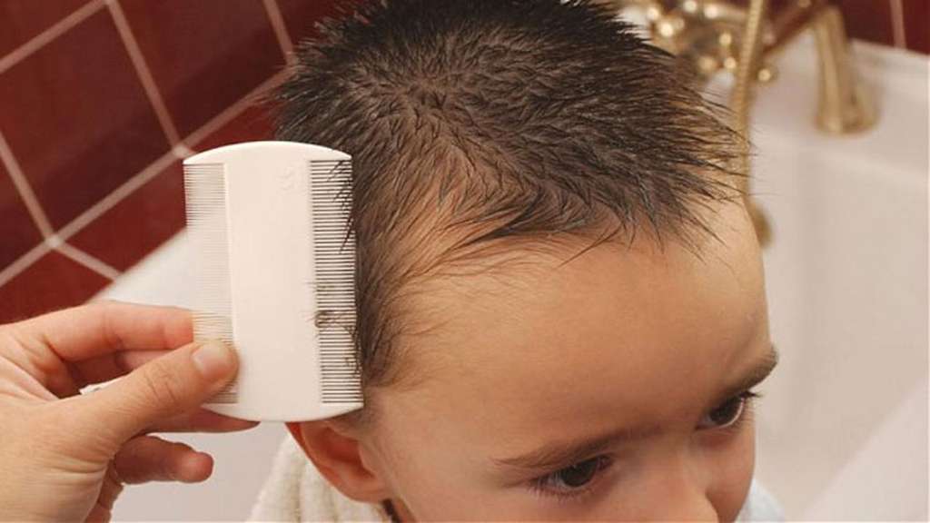 sisir rambut untuk kutu