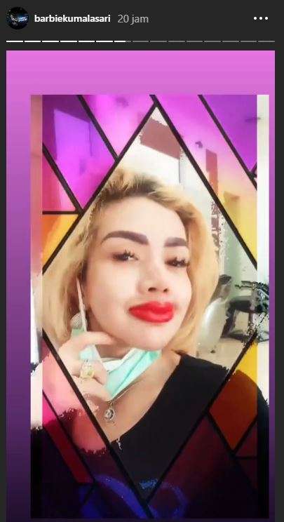 bentuk bibir barbie kumalasari