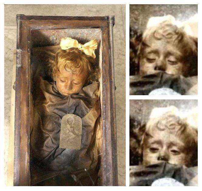 Rosalia Lombardo, mumi tercantik berjuluk Putri Tidur