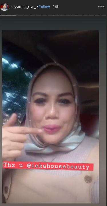 elly sugigi gigi baru