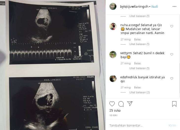 awal kehamilan istri markus horison