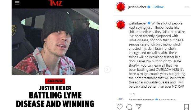 Justin Bieber
