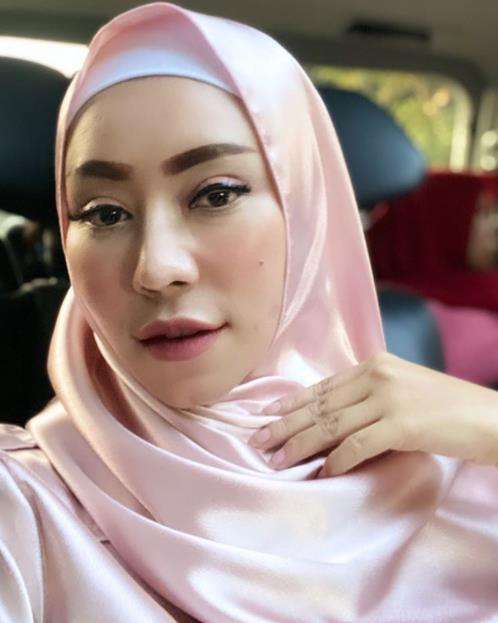 Sejak menderita penyakit aneh, Baby Sexyola berhijab.