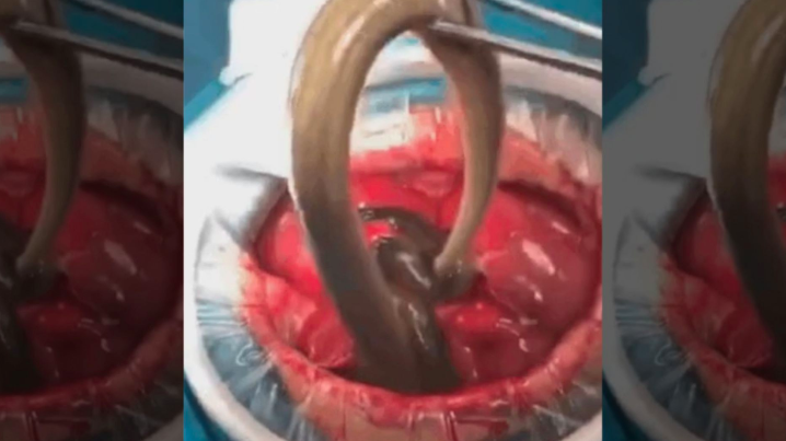 Pria Makan Belut