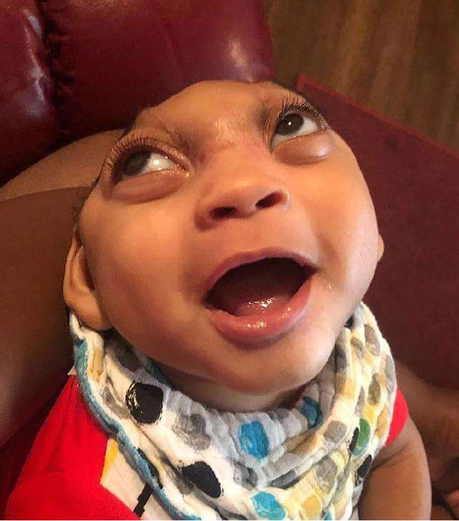 Ozzie Gordon lahir dengan kondisi yang disebut anencephaly.