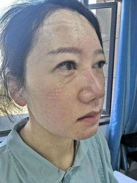 Kondisi perawat yang tangani virus Corona