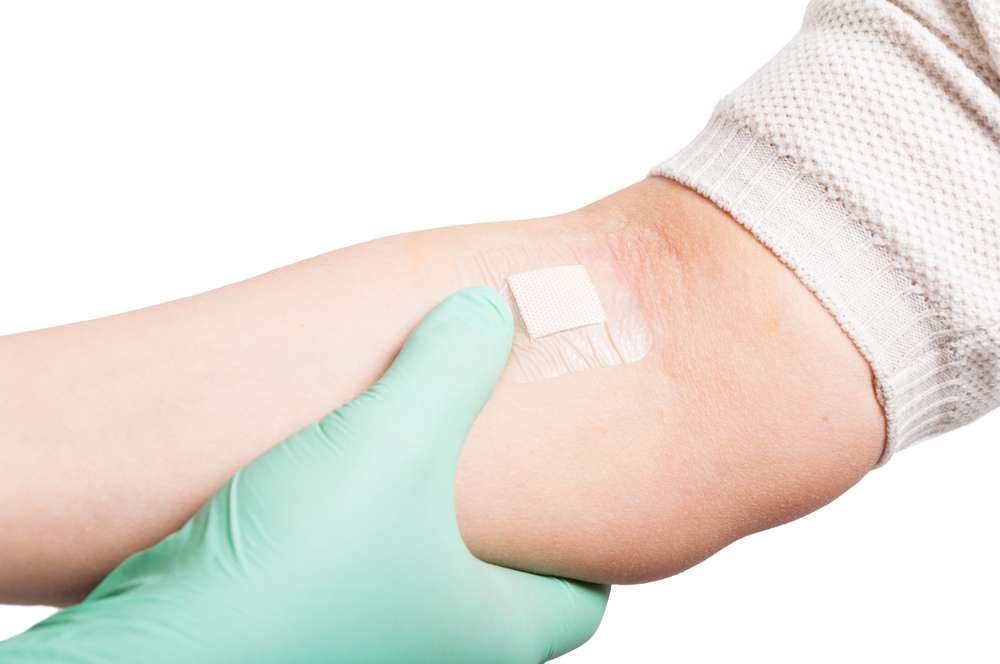 ilustrasi patch test