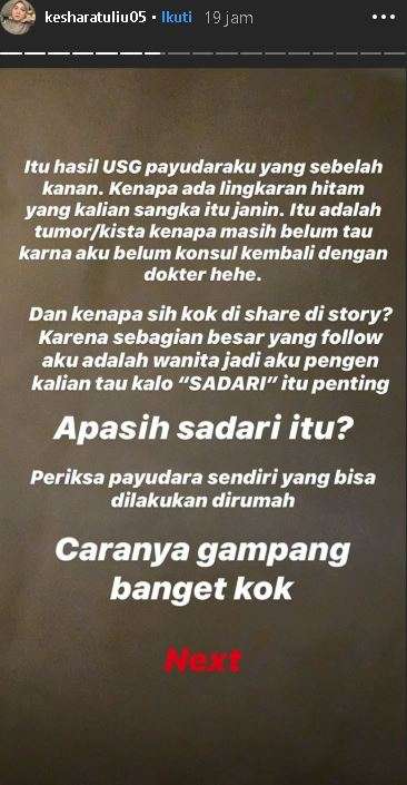 unggahan Kesha Ratuliu