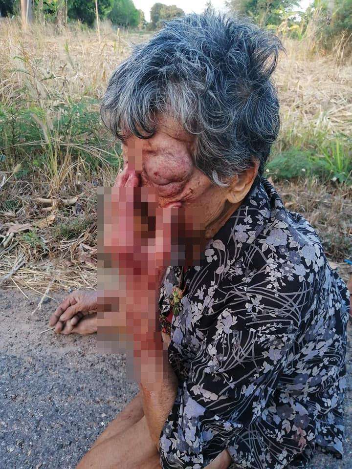 Mata nenek ini bengkak dan tangannya luka dihajar cucunya.