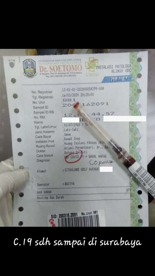 Hasil tes Covid-19 yang beredar (Foto: Istimewa)