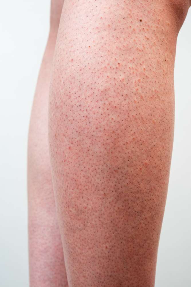 Ilustrasi strawberry legs