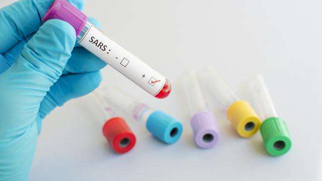 Virus SARS