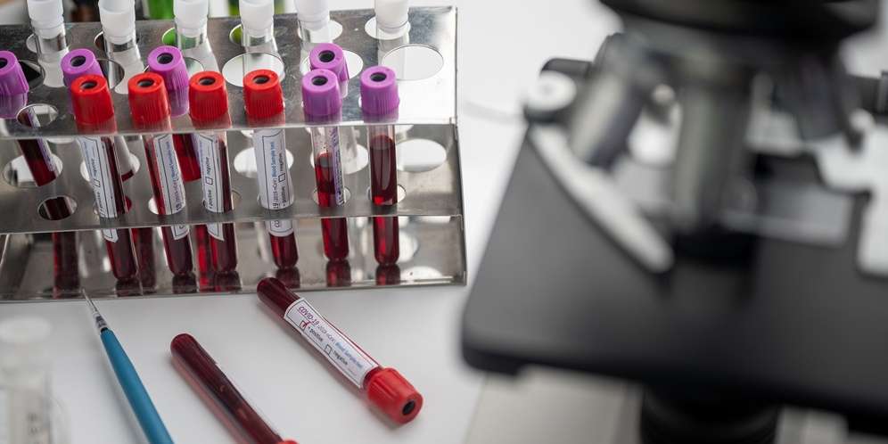 Vaksin Virus Corona Covid-19