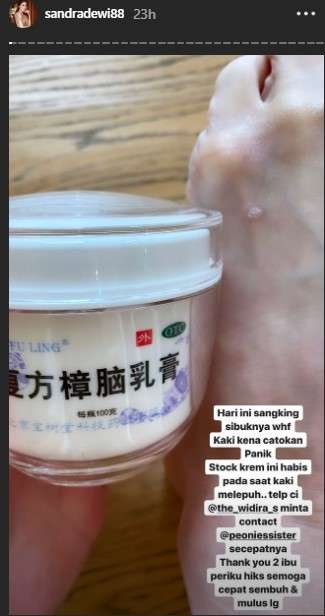 Kaki Sandra Dewi Melepuh Kaki Sandra Dewi Melepuh